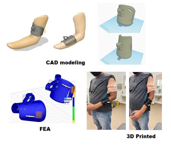 Index terms: Adaptive assistive device; Brachial plexus injury; Finite element analysis; Patient-specific; 3D printing