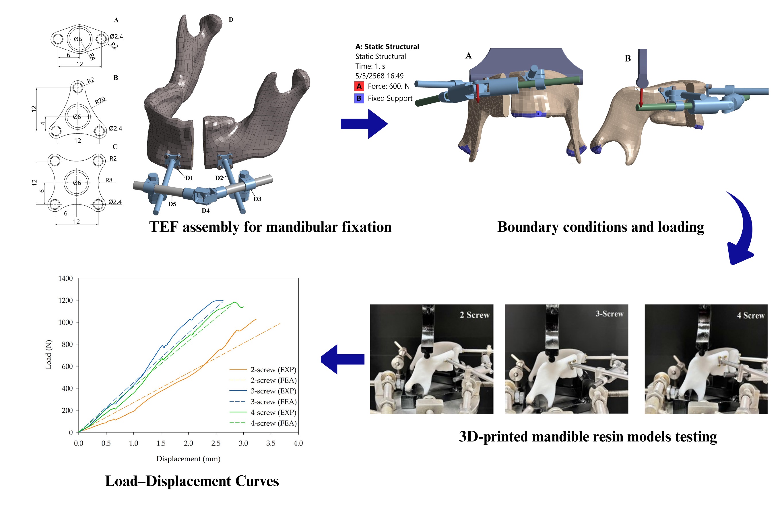 Index terms: Biomechanical performance; Finite element analysis; Mandibular reconstruction;  Screw-Plate system; Temporary external fixator